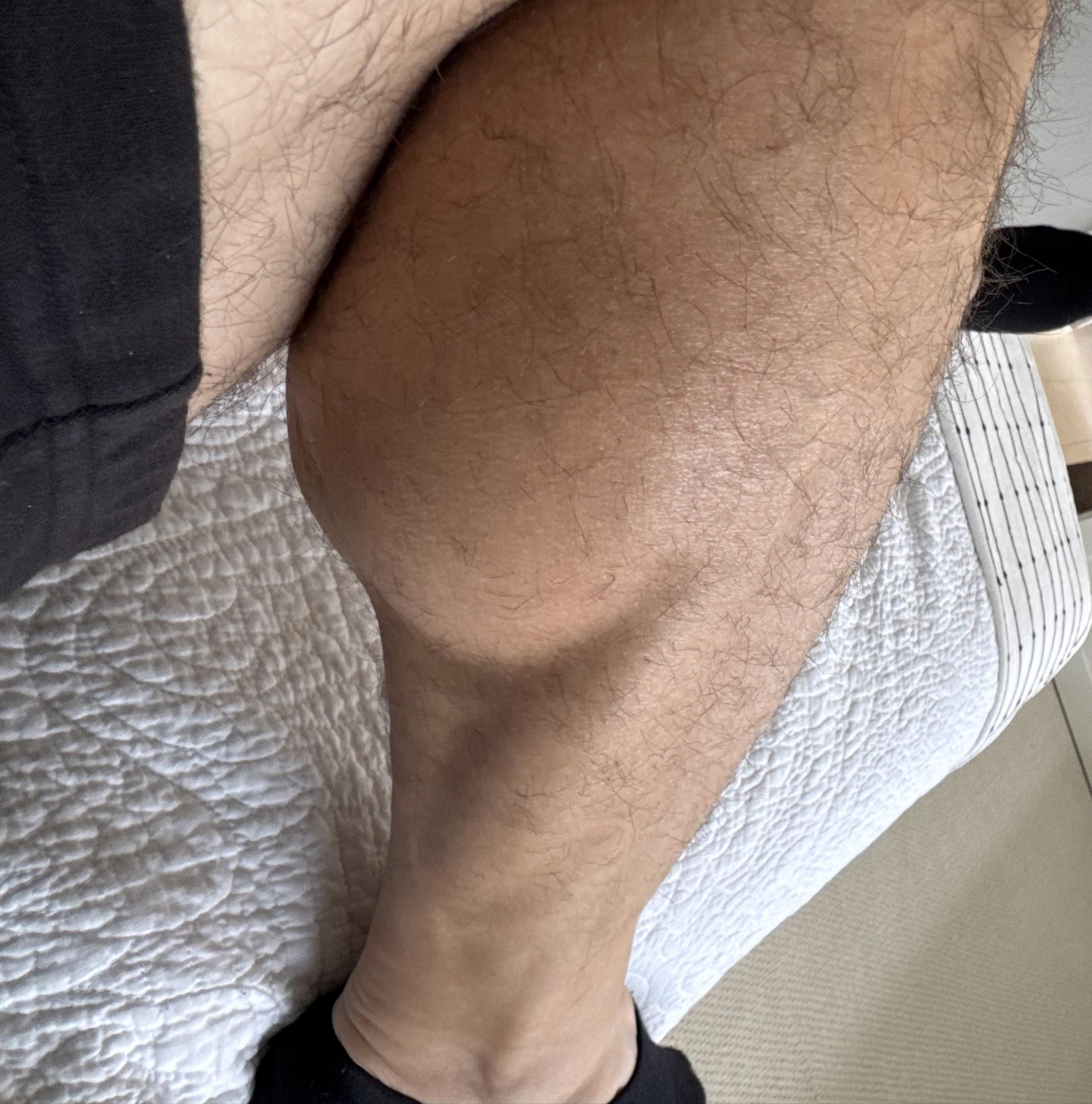 Calf.jpg